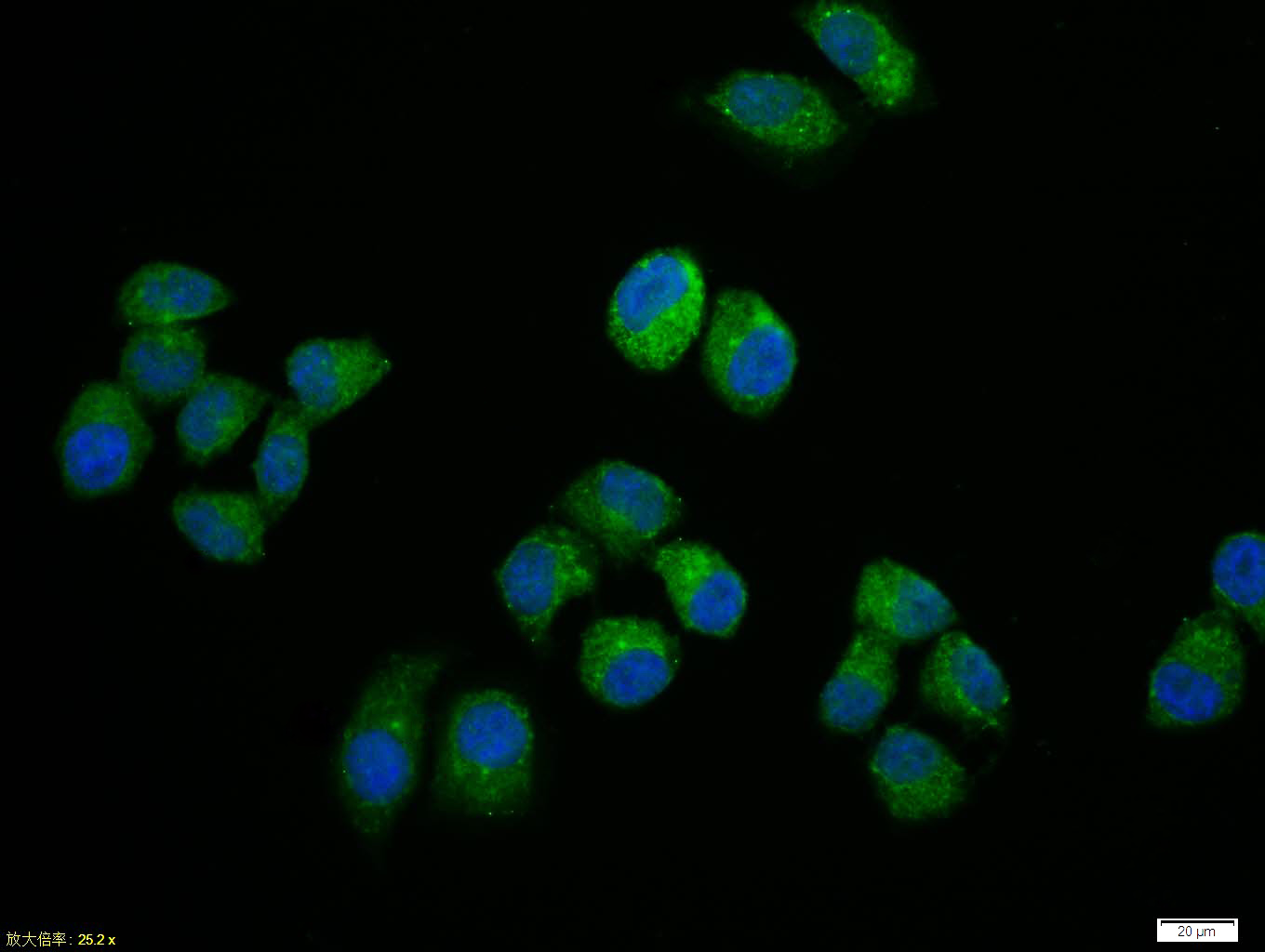 Tissue\/cell:Hela cell; 4% Paraformaldehyde-fixed; Triton X-100 at room temperature for 20 min; Blocking buffer (normal goat serum,C-0005) at 37\u00b0C for 20 min; Antibody incubation with (NFKB p65) polyclonal Antibody, Unconjugated (bs-0465R) 1:100, 90 minutes at 37\u00b0C; followed by a FITC conjugated Goat Anti-Rabbit IgG antibody at 37\u00b0C for 90 minutes, DAPI (blue, C02-04002) was used to stain the cell nuclei.