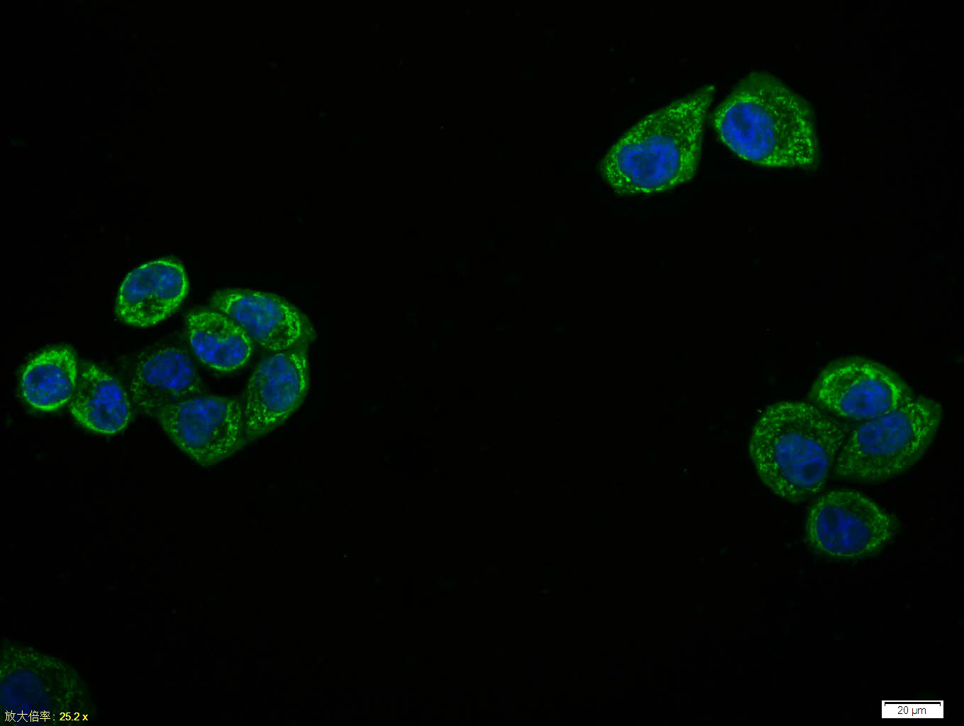 Tissue/cell:Hela cell; 4% Paraformaldehyde-fixed; Triton X-100 at room temperature for 20 min; Blocking buffer (normal goat serum,C-0005) at 37°C for 20 min; Antibody incubation with (phospho-NFKB p65 (Thr435)) polyclonal Antibody, Unconjugated (bs-5661R) 1:100, 90 minutes at 37°C; followed by a FITC conjugated Goat Anti-Rabbit IgG antibody at 37°C for 90 minutes, DAPI (blue, C02-04002) was used to stain the cell nuclei.
