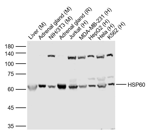 Lane 1: Mouse Liver lysates; Lane 2: Mouse Adrenal gland lysates; Lane 3: Mouse NIH/3T3 cell lysates; Lane 4: Rat Adrenal gland lysates; Lane 5: Human Jurkat cell lysates; Lane 6: Human MDA-MB-231 cell lysates; Lane 7: Human HepG2 cell lysates; Lane 8: Human Hela cell lysates; Lane 9: Human K562 cell lysates probed with HSP60 Polyclonal Antibody, Unconjugated (bs-0191R) at 1:1000 dilution and 4˚C overnight incubation. Followed by conjugated secondary antibody incubation at 1:20000 for 60 min at 37˚C.