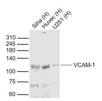 Lane 1: Human Siha cell lysates; Lane 2: Human HUVEC cell lysates; Lane 3: Human U251 cell lysates probed with VCAM-1 Polyclonal Antibody, Unconjugated (bs-0396R) at 1:1000 dilution and 4˚C overnight incubation. Followed by conjugated secondary antibody incubation at 1:20000 for 60 min at 37˚C.