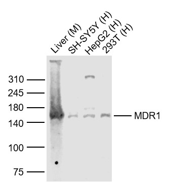 Lane 1: Mouse Liver lysates; Lane 2: Human SH-SY5Y cell lysates; Lane 3: Human HepG2 cell lysates; Lane 4: Human 293T cell lysates probed with MDR1 Polyclonal Antibody, Unconjugated (bs-0563R) at 1:1000 dilution and 4˚C overnight incubation. Followed by conjugated secondary antibody incubation at 1:20000 for 60 min at 37˚C.