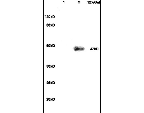 Lane 1: rat brain lysates Lane 2: human colon carcinoma lysates probed with Anti VIP Receptor 1/VAPC1 Polyclonal Antibody, Unconjugated (bs-2982R) at 1:200 in 4˚C. Followed by conjugation to secondary antibody (bs-0295G-HRP) at 1:3000 90min in 37˚C. Predicted band 47kD. Observed band size: 47kD