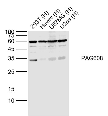 Lane 1: Human 293T cell lysates; Lane 2: Human HUVEC cell lysates; Lane 3: Human U-87MG cell lysates; Lane 4: Human U-2OS cell lysates probed with PAG608 Polyclonal Antibody, Unconjugated (bs-0942R) at 1:1000 dilution and 4˚C overnight incubation. Followed by conjugated secondary antibody incubation at 1:20000 for 60 min at 37˚C.
