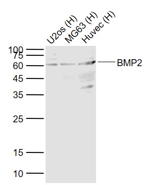 Lane 1: Human U-2OS cell lysates; Lane 2: Human MG63 cell lysates; Lane 3: Human HUVEC cell lysates probed with BMP2 Polyclonal Antibody, Unconjugated (bs-1012R) at 1:1000 dilution and 4˚C overnight incubation. Followed by conjugated secondary antibody incubation at 1:20000 for 60 min at 37˚C.