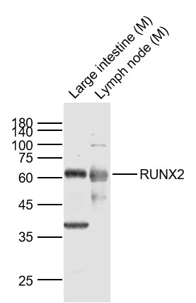 Lane 1: Mouse Large intestine lysates; Lane 2: Mouse Lymph node lysates probed with RUNX2 Polyclonal Antibody, Unconjugated (bs-1134R) at 1:1000 dilution and 4˚C overnight incubation. Followed by conjugated secondary antibody incubation at 1:20000 for 60 min at 37˚C.