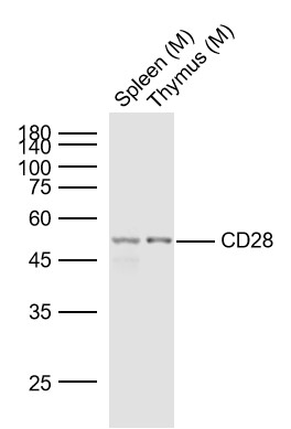 Lane 1: Mouse Spleen lysates; Lane 2: Mouse Thymus lysates probed with CD28 Polyclonal Antibody, Unconjugated (bs-1297R) at 1:1000 dilution and 4˚C overnight incubation. Followed by conjugated secondary antibody incubation at 1:20000 for 60 min at 37˚C.