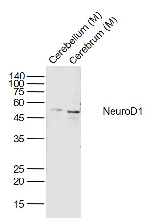 Lane 1: Mouse Cerebellum lysates; Lane 2: Mouse Cerebrum lysates probed with NeuroD1 Polyclonal Antibody, Unconjugated (bs-1517R) at 1:1000 dilution and 4˚C overnight incubation. Followed by conjugated secondary antibody incubation at 1:20000 for 60 min at 37˚C.