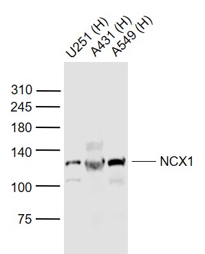 Lane 1: Human U251 cell lysates; Lane 2: Human A431 cell lysates; Lane 3: Human A549 cell lysates probed with NCX1/SLC8A1 Polyclonal Antibody, Unconjugated (bs-1550R) at 1:1000 dilution and 4˚C overnight incubation. Followed by conjugated secondary antibody incubation at 1:20000 for 60 min at 37˚C.