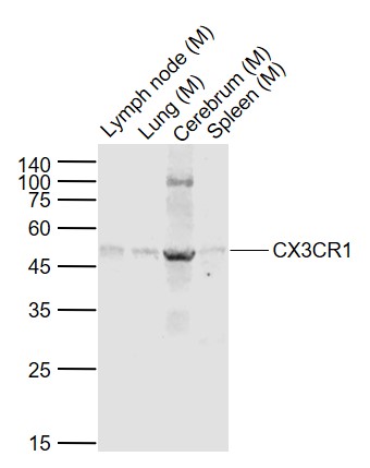 Lane 1: Mouse Lymph node lysates; Lane 2: Mouse Lung lysates; Lane 3: Mouse Cerebrum lysates; Lane 4: Mouse Spleen cell lysates probed with CX3CR1 Polyclonal Antibody, Unconjugated (bs-1728R) at 1:1000 dilution and 4˚C overnight incubation. Followed by conjugated secondary antibody incubation at 1:20000 for 60 min at 37˚C.