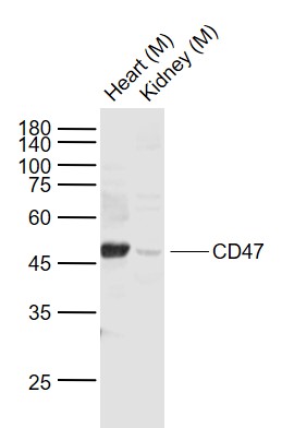 Lane 1: Mouse Heart lysates; Lane 2: Mouse Kidney lysates probed with CD47\/MER6 Polyclonal Antibody, Unconjugated (bs-2386R) at 1:1000 dilution and 4˚C overnight incubation. Followed by conjugated secondary antibody incubation at 1:20000 for 60 min at 37˚C.