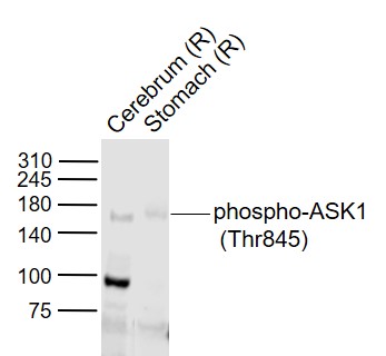 Lane 1: Rat Cerebrum lysates; Lane 2: Rat Stomach lysates probed with phospho-ASK1 Polyclonal Antibody, Unconjugated (bs-3031R) at 1:1000 dilution and 4˚C overnight incubation. Followed by conjugated secondary antibody incubation at 1:20000 for 60 min at 37˚C.