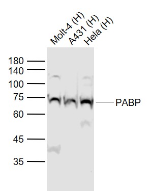Lane 1: Human MOLT-4 cell lysates; Lane 2: Human A431 cell lysates; Lane 3: Human Hela cell lysates probed with PABP Polyclonal Antibody, Unconjugated (bs-3833R) at 1:1000 dilution and 4˚C overnight incubation. Followed by conjugated secondary antibody incubation at 1:20000 for 60 min at 37˚C.