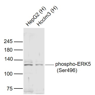 Lane 1: Human HepG2 cell lysates; Lane 2: Human Hcclm3 cell lysates probed with ERK5 (Ser496) Polyclonal Antibody, Unconjugated (bs-5484R) at 1:300 dilution and 4˚C overnight incubation. Followed by conjugated secondary antibody incubation at 1:20000 for 60 min at 37˚C.