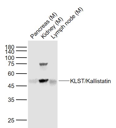 Lane 1: Mouse Pancreas lysates; Lane 2: Mouse Kidney lysates; Lane 3: Mouse Lymph node lysates probed with KLST Polyclonal Antibody, Unconjugated (bs-5786R) at 1:1000 dilution and 4˚C overnight incubation. Followed by conjugated secondary antibody incubation at 1:20000 for 60 min at 37˚C.