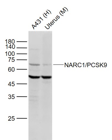Lane 1: Human A431 cell lysates; Lane 2: Mouse Uterus lysates probed with NARC1 Polyclonal Antibody, Unconjugated (bs-6060R) at 1:1000 dilution and 4˚C overnight incubation. Followed by conjugated secondary antibody incubation at 1:20000 for 60 min at 37˚C.