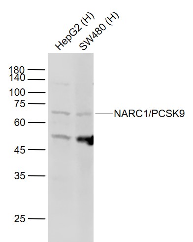 Lane 1: Human HepG2 cell lysates; Lane 2: Human SW480 cell lysates probed with NARC1 Polyclonal Antibody, Unconjugated (bs-6060R) at 1:1000 dilution and 4˚C overnight incubation. Followed by conjugated secondary antibody incubation at 1:20000 for 60 min at 37˚C.