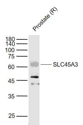 Lane 1: Rat Prostate lysates probed with SLC45A3 Polyclonal Antibody, Unconjugated (bs-6568R) at 1:1000 dilution and 4˚C overnight incubation. Followed by conjugated secondary antibody incubation at 1:20000 for 60 min at 37˚C.
