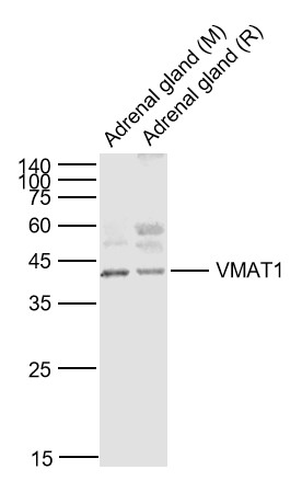 Lane 1: Mouse Adrenal gland lysates; Lane 2: Rat Adrenal gland lysates probed with VMAT1 Polyclonal Antibody, Unconjugated (bs-6677R) at 1:1000 dilution and 4˚C overnight incubation. Followed by conjugated secondary antibody incubation at 1:20000 for 60 min at 37˚C.