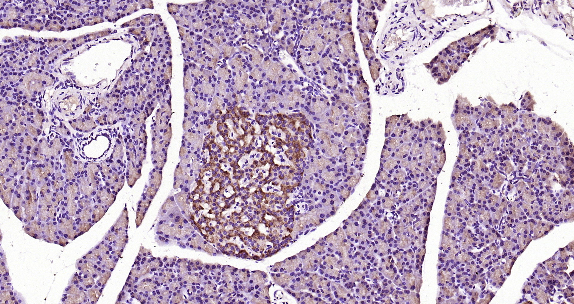 Paraformaldehyde-fixed, paraffin embedded Mouse pancreas; Antigen retrieval by boiling in sodium citrate buffer (pH6.0) for 15min; Block endogenous peroxidase by 3% hydrogen peroxide for 20 minutes; Blocking buffer (normal goat serum) at 37°C for 30min; Antibody incubation with MyD88 Polyclonal Antibody, Unconjugated (bs-1047R) at 1:200 overnight at 4°C, DAB staining. Paraformaldehyde-fixed, paraffin embedded Mouse pancreas; Antigen retrieval by boiling in sodium citrate buffer (pH6.0) for 15min; Block endogenous peroxidase by 3% hydrogen peroxide for 20 minutes; Blocking buffer (normal goat serum) at 37°C for 30min; Antibody incubation with MyD88 Polyclonal Antibody, Unconjugated (bs-1047R) at 1:200 overnight at 4°C, DAB staining.