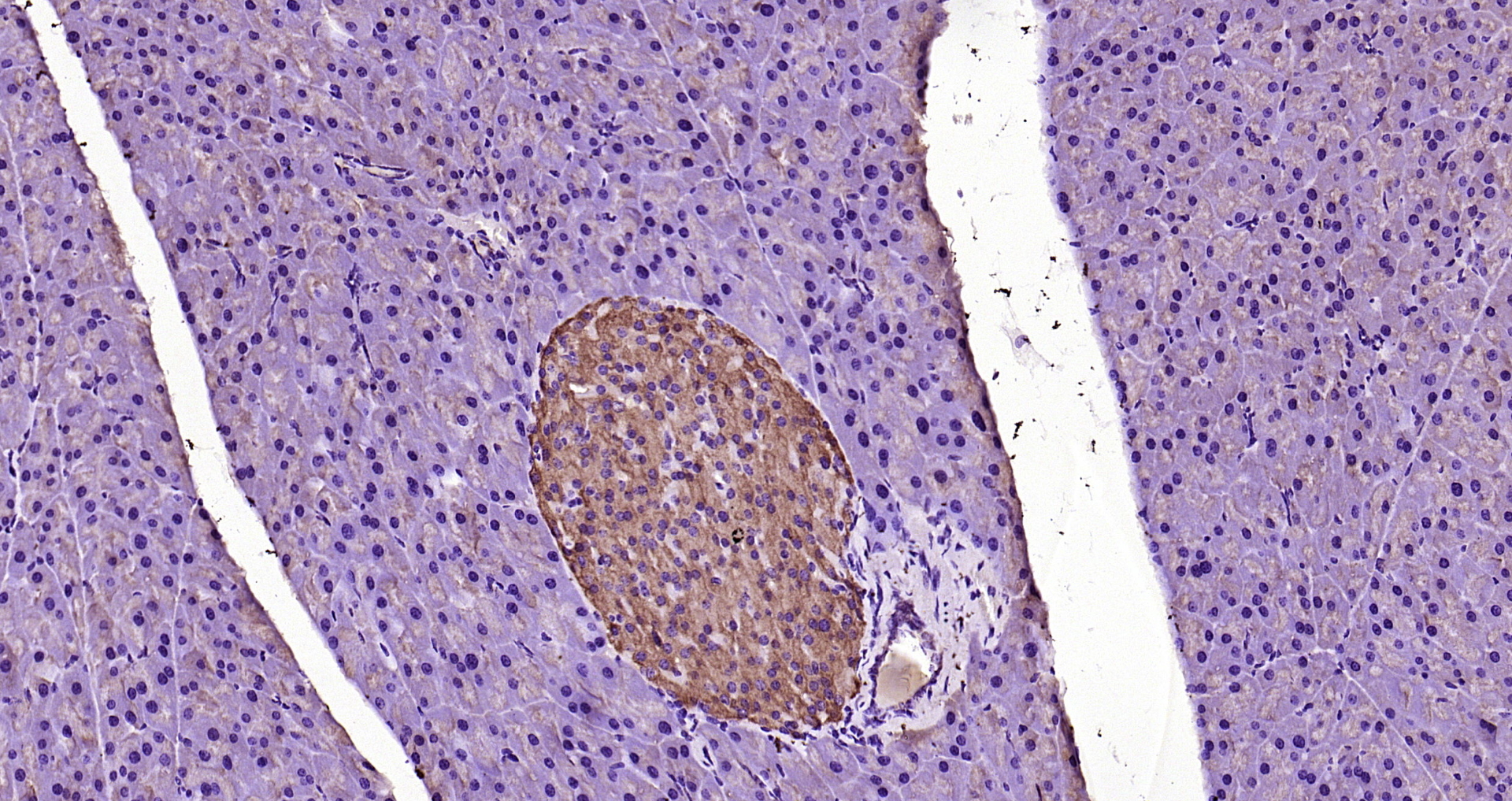 Paraformaldehyde-fixed, paraffin embedded Rat pancreas; Antigen retrieval by boiling in sodium citrate buffer (pH6.0) for 15min; Block endogenous peroxidase by 3% hydrogen peroxide for 20 minutes; Blocking buffer (normal goat serum) at 37°C for 30min; Antibody incubation with MyD88 Polyclonal Antibody, Unconjugated (bs-1047R) at 1:200 overnight at 4°C, DAB staining. Paraformaldehyde-fixed, paraffin embedded Rat pancreas; Antigen retrieval by boiling in sodium citrate buffer (pH6.0) for 15min; Block endogenous peroxidase by 3% hydrogen peroxide for 20 minutes; Blocking buffer (normal goat serum) at 37°C for 30min; Antibody incubation with MyD88 Polyclonal Antibody, Unconjugated (bs-1047R) at 1:200 overnight at 4°C, DAB staining.