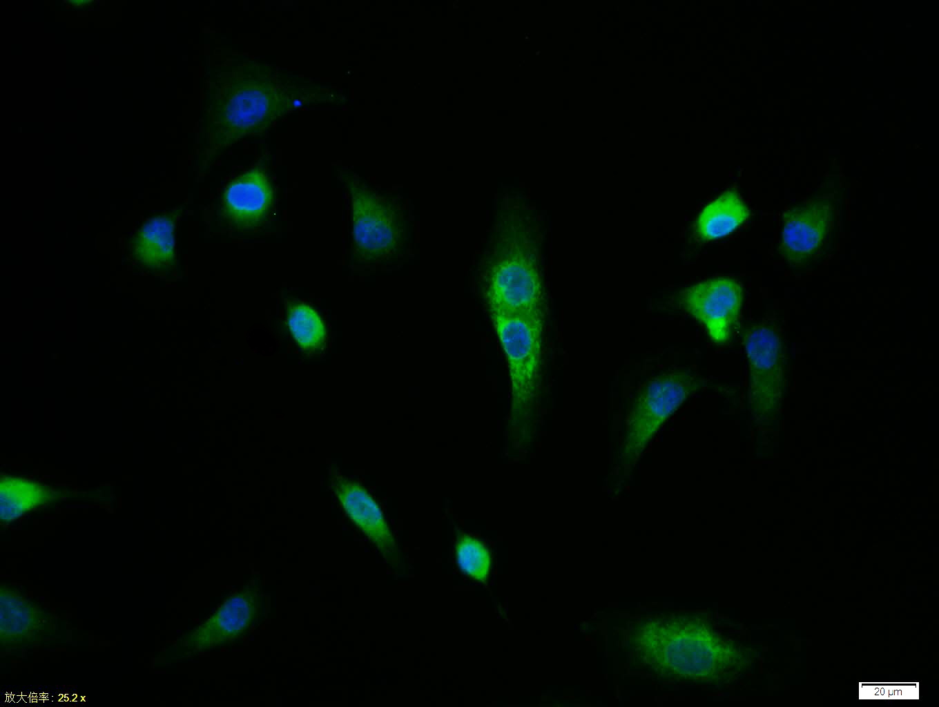 Tissue/cell:A549 cell; 4% Paraformaldehyde-fixed; Triton X-100 at room temperature for 20 min; Blocking buffer (normal goat serum,C-0005) at 37°C for 20 min; Antibody incubation with (Integrin beta 1) polyclonal Antibody, Unconjugated (bs-0486R) 1:100, 90 minutes at 37°C; followed by a FITC conjugated Goat Anti-Rabbit IgG antibody at 37°C for 90 minutes, DAPI (blue, C02-04002) was used to stain the cell nuclei.