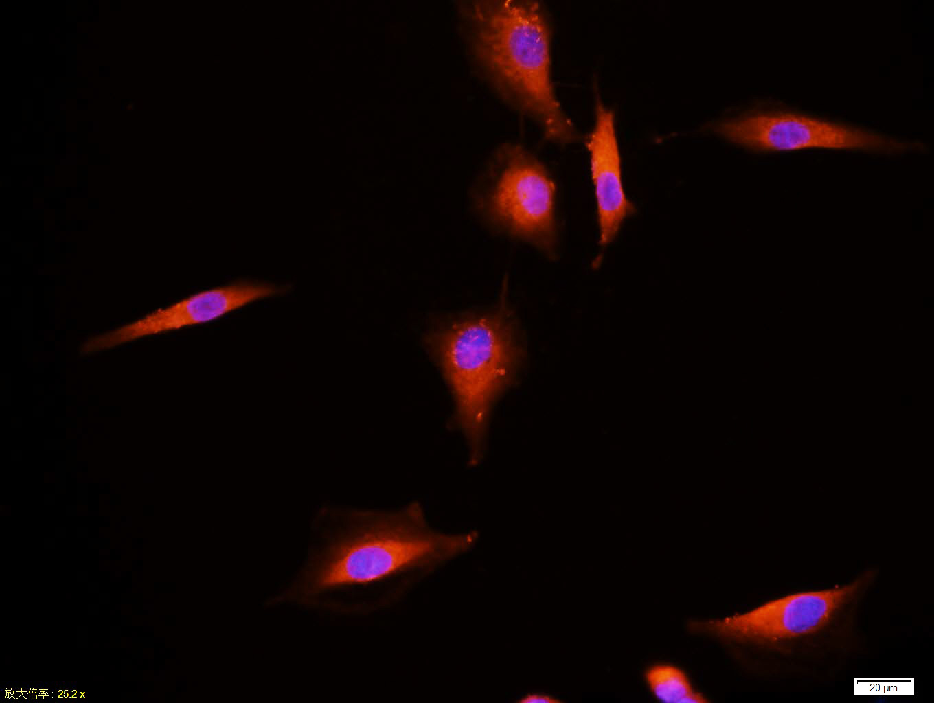 Tissue/cell:A549 cell; 4% Paraformaldehyde-fixed; Triton X-100 at room temperature for 20 min; Blocking buffer (normal goat serum,C-0005) at 37°C for 20 min; Antibody incubation with (HER2 receptor) monoclonal Antibody, Unconjugated (bsm-2156M) 1:100, 90 minutes at 37°C; followed by a CY3 conjugated Goat Anti-Mouse IgG antibody at 37°C for 90 minutes, DAPI (blue, C02-04002) was used to stain the cell nuclei. Tissue/cell:A549 cell; 4% Paraformaldehyde-fixed; Triton X-100 at room temperature for 20 min; Blocking buffer (normal goat serum,C-0005) at 37°C for 20 min; Antibody incubation with (HER2 receptor) monoclonal Antibody, Unconjugated (bsm-2156M) 1:100, 90 minutes at 37°C; followed by a CY3 conjugated Goat Anti-Mouse IgG antibody at 37°C for 90 minutes, DAPI (blue, C02-04002) was used to stain the cell nuclei.