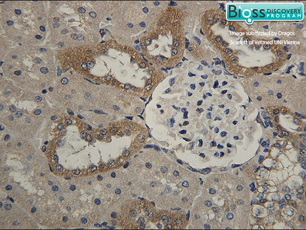 Formalin-fixed and paraffin embedded rat kidney labeled with Anti- HSD11B2 Polyclonal Antibody, Unconjugated (bs-3618R) at 1:200 followed by conjugation to the secondary antibody and DAB staining Formalin-fixed and paraffin embedded rat kidney labeled with Anti- HSD11B2 Polyclonal Antibody, Unconjugated (bs-3618R) at 1:200 followed by conjugation to the secondary antibody and DAB staining