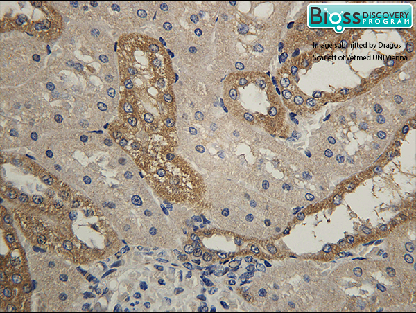 Formalin-fixed and paraffin embedded rat kidney labeled with Anti- HSD11B2 Polyclonal Antibody, Unconjugated (bs-3618R) at 1:200 followed by conjugation to the secondary antibody and DAB staining Formalin-fixed and paraffin embedded rat kidney labeled with Anti- HSD11B2 Polyclonal Antibody, Unconjugated (bs-3618R) at 1:200 followed by conjugation to the secondary antibody and DAB staining
