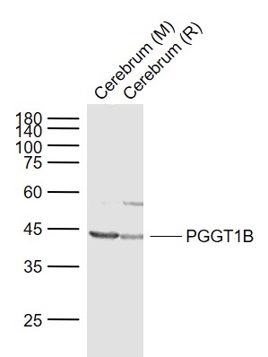 Lane 1: Mouse Cerebrum lysates; Lane 2: Rat Cerebrum lysates probed with PGGT1B Polyclonal Antibody, Unconjugated (bs-9372R) at 1:1000 dilution and 4˚C overnight incubation. Followed by conjugated secondary antibody incubation at 1:20000 for 60 min at 37˚C.
