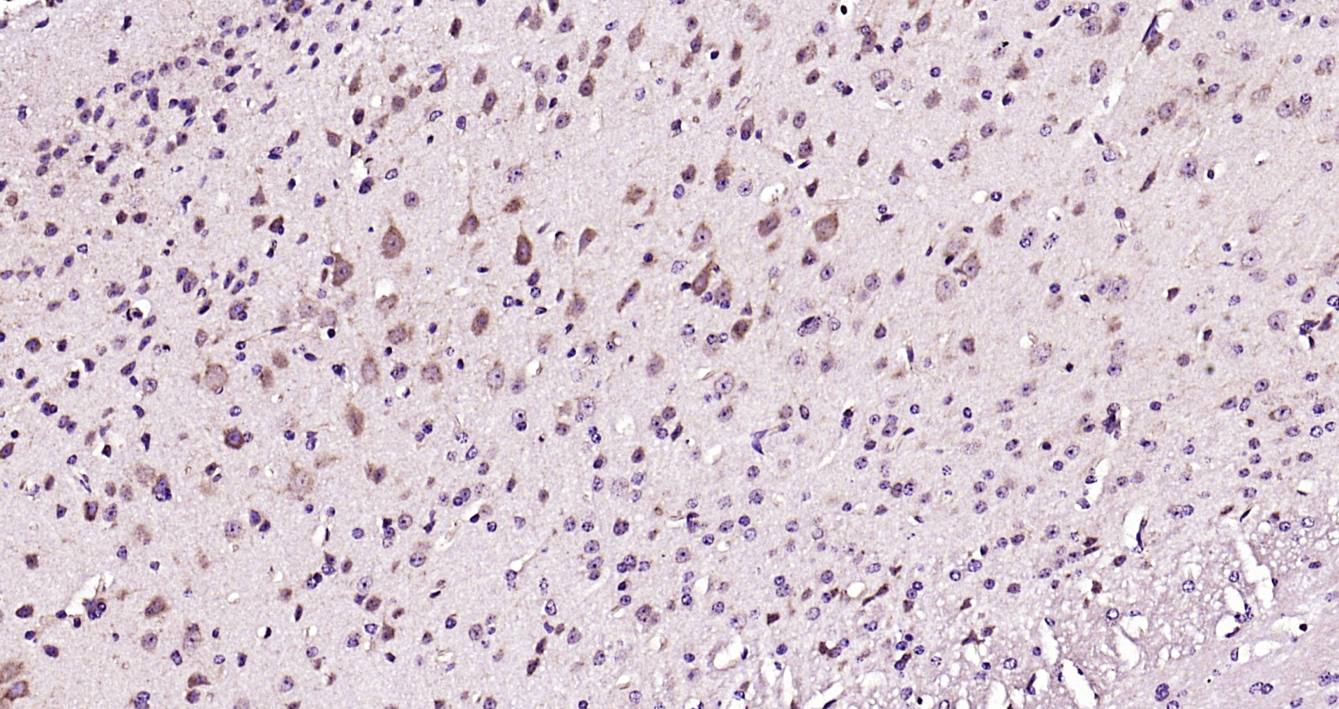 Paraformaldehyde-fixed, paraffin embedded Mouse brain; Antigen retrieval by boiling in sodium citrate buffer (pH6.0) for 15min; Block endogenous peroxidase by 3% hydrogen peroxide for 20 minutes; Blocking buffer (normal goat serum) at 37°C for 30min; Antibody incubation with Leptin Polyclonal Antibody, Unconjugated (bs-0409R) at 1:200 overnight at 4°C, DAB staining.