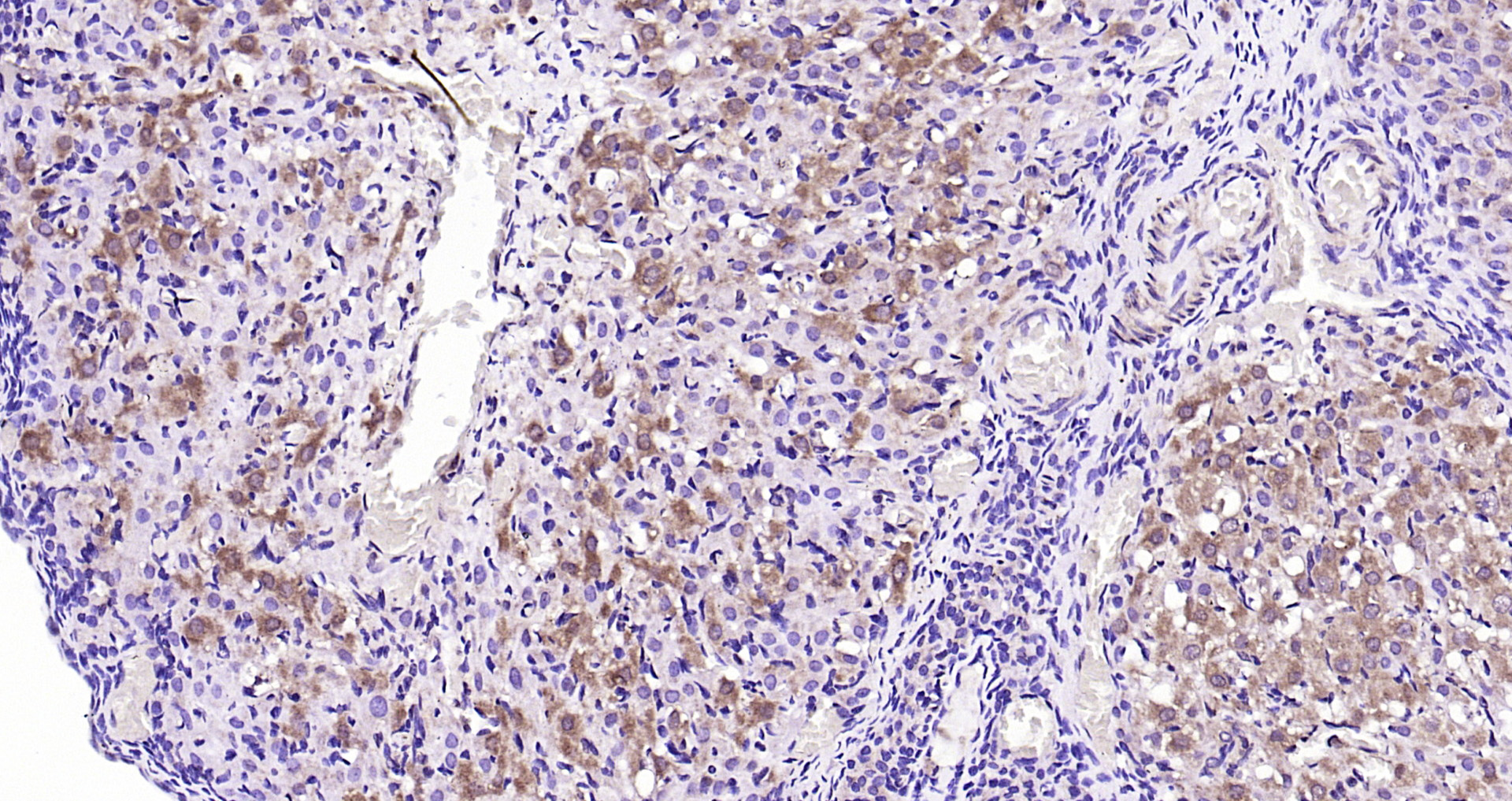 Paraformaldehyde-fixed, paraffin embedded Rat ovarian; Antigen retrieval by boiling in sodium citrate buffer (pH6.0) for 15min; Block endogenous peroxidase by 3% hydrogen peroxide for 20 minutes; Blocking buffer (normal goat serum) at 37°C for 30min; Antibody incubation with Leptin Polyclonal Antibody, Unconjugated (bs-0409R) at 1:200 overnight at 4°C, DAB staining.