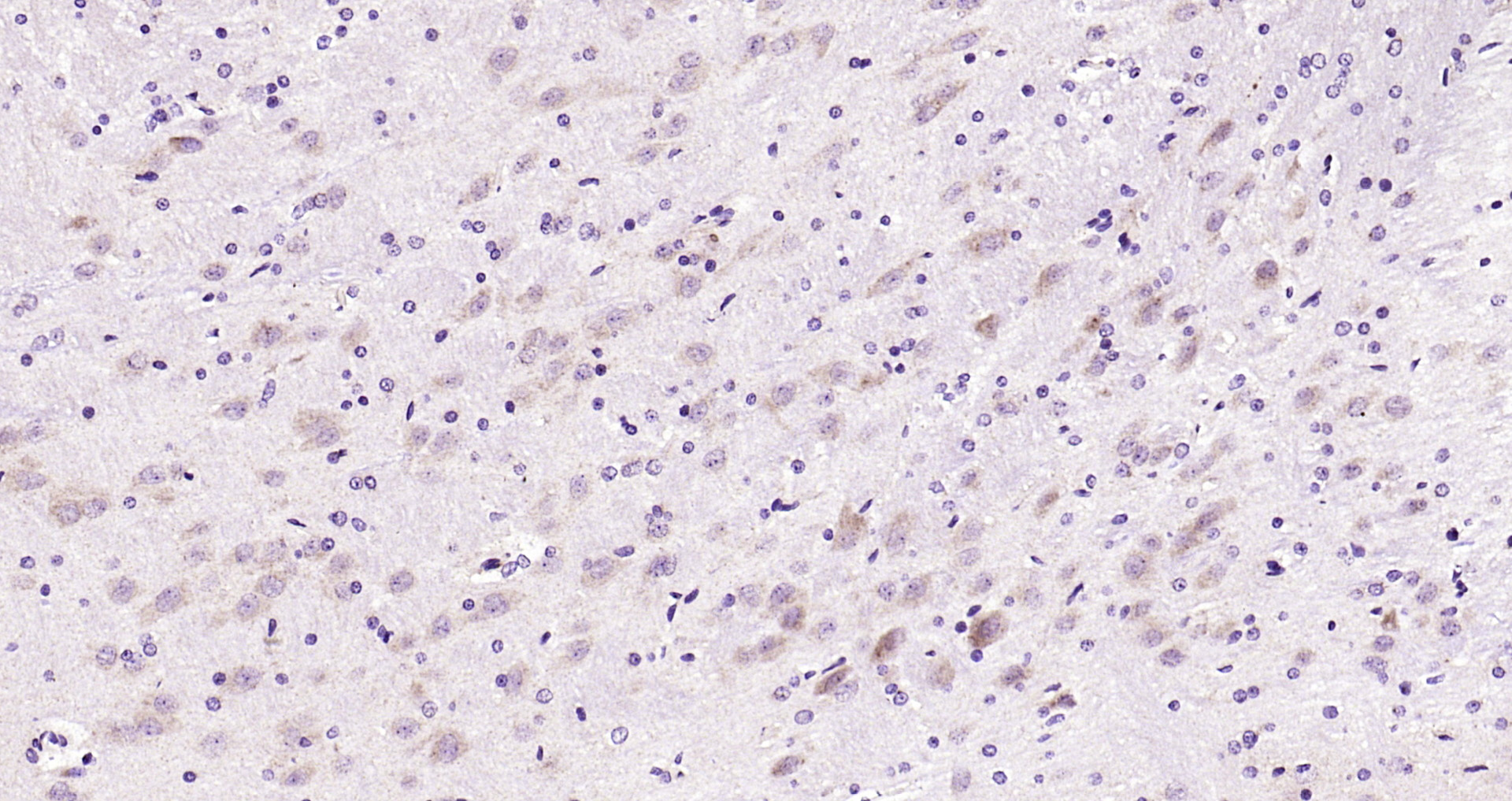 Paraformaldehyde-fixed, paraffin embedded Rat brain; Antigen retrieval by boiling in sodium citrate buffer (pH6.0) for 15min; Block endogenous peroxidase by 3% hydrogen peroxide for 20 minutes; Blocking buffer (normal goat serum) at 37°C for 30min; Antibody incubation with Leptin Polyclonal Antibody, Unconjugated (bs-0409R) at 1:200 overnight at 4°C, DAB staining.