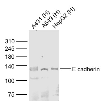 Lane 1: Human A431 cell lysates; Lane 2: Human A549 cell lysates; Lane 3: Human HepG2 cell lysates probed with E cadherin Polyclonal Antibody, Unconjugated (bs-10009R) at 1:1000 dilution and 4˚C overnight incubation. Followed by conjugated secondary antibody incubation at 1:20000 for 60 min at 37˚C.