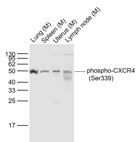 Lane 1: Mouse Lung lysates; Lane 2: Mouse Spleen lysates; Lane 3: Mouse Uterus lysates; Lane 4: Mouse Lymph node lysates probed with CXCR4 Polyclonal Antibody, Unconjugated (bs-12256R) at 1:1000 dilution and 4˚C overnight incubation. Followed by conjugated secondary antibody incubation at 1:20000 for 60 min at 37˚C.