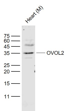 Lane 1: Mouse Heart lysates probed with OVOL2/ZNF339 Polyclonal Antibody, Unconjugated (bs-12274R) at 1:300 dilution and 4˚C overnight incubation. Followed by conjugated secondary antibody incubation at 1:20000 for 60 min at 37˚C.