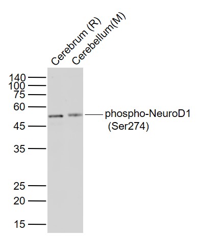 Lane 1: Rat Cerebrum lysates; Lane 2: Mouse Cerebellum lysates probed with phospho-NeuroD1 Polyclonal Antibody, Unconjugated (bs-19218R) at 1:300 dilution and 4˚C overnight incubation. Followed by conjugated secondary antibody incubation at 1:20000 for 60 min at 37˚C.