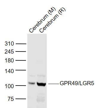 Lane 1: Mouse Cerebrum lysates; Lane 2: Rat Cerebrum lysates probed with GPR49/LGR5 Polyclonal Antibody, Unconjugated (bs-20746R) at 1:1000 dilution and 4˚C overnight incubation. Followed by conjugated secondary antibody incubation at 1:20000 for 60 min at 37˚C. Lane 1: Mouse Cerebrum lysates; Lane 2: Rat Cerebrum lysates probed with GPR49/LGR5 Polyclonal Antibody, Unconjugated (bs-20746R) at 1:1000 dilution and 4˚C overnight incubation. Followed by conjugated secondary antibody incubation at 1:20000 for 60 min at 37˚C.