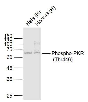 Lane 1: Human Hela cell lysates; Lane 2: Human Hcclm3 cell lysates probed with PKR(T446) (10A1) Monoclonal Antibody, Unconjugated (bsm-52189R) at 1:1000 dilution and 4˚C overnight incubation. Followed by conjugated secondary antibody incubation at 1:20000 for 60 min at 37˚C.