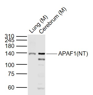 Lane 1: Mouse Lung lysates; Lane 2: Mouse Cerebrum lysates probed with APAF1 Polyclonal Antibody, Unconjugated (bs-0059R) at 1:1000 dilution and 4˚C overnight incubation. Followed by conjugated secondary antibody incubation at 1:20000 for 60 min at 37˚C.