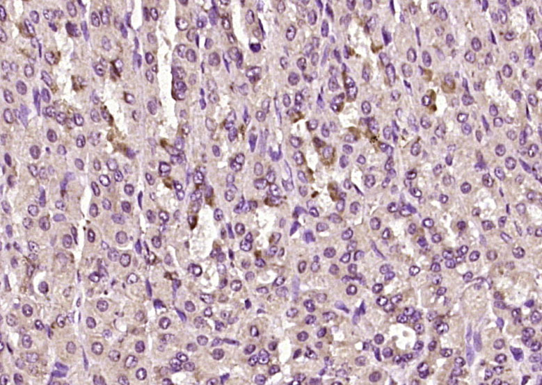 Paraformaldehyde-fixed, paraffin embedded Rat stomach; Antigen retrieval by boiling in sodium citrate buffer (pH6.0) for 15min; Block endogenous peroxidase by 3% hydrogen peroxide for 20 minutes; Blocking buffer (normal goat serum) at 37°C for 30min; Antibody incubation with RSPO1 Polyclonal Antibody, Unconjugated (bs-21385R) at 1:200 overnight at 4°C, DAB staining.