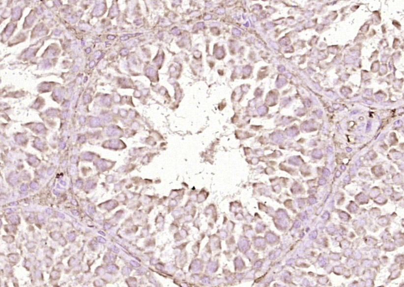 Paraformaldehyde-fixed, paraffin embedded Rat testis; Antigen retrieval by boiling in sodium citrate buffer (pH6.0) for 15min; Block endogenous peroxidase by 3% hydrogen peroxide for 20 minutes; Blocking buffer (normal goat serum) at 37°C for 30min; Antibody incubation with RSPO1 Polyclonal Antibody, Unconjugated (bs-21385R) at 1:200 overnight at 4°C, DAB staining.