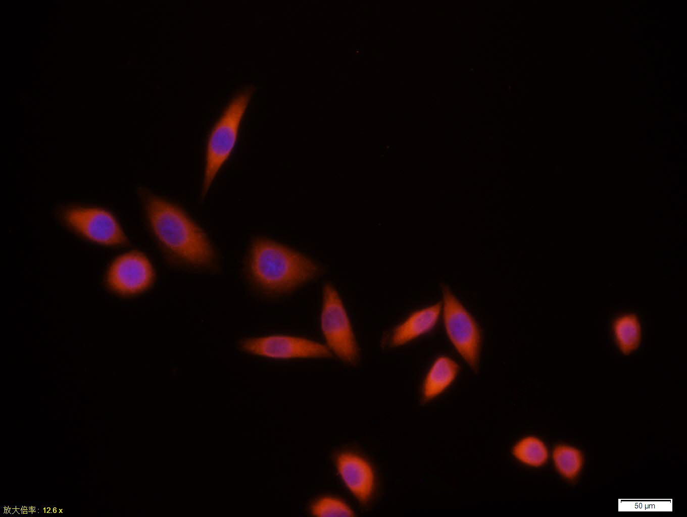 Tissue\/cell:MCF7 cell; 4% Paraformaldehyde-fixed; Triton X-100 at room temperature for 20 min; Blocking buffer (normal goat serum,C-0005) at 37\u00b0C for 20 min; Antibody incubation with (NFKB p65) monoclonal Antibody, Unconjugated (bsm-33117M)1:100, 90 minutes at 37\u00b0C; followed by a CY3 conjugated Goat Anti-Mouse IgG antibody at 37\u00b0C for 90 minutes, DAPI (blue, C02-04002) was used to stain the cell nuclei.