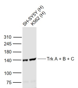 Lane 1: Human SH-SY5Y cell lysates; Lane 2: Human K562 cell lysates probed withTyrosine Kinase Receptor  Polyclonal Antibody, Unconjugated (bs-0192R) at 1:1000 dilution and 4˚C overnight incubation. Followed by conjugated secondary antibody incubation at 1:20000 for 60 min at 37˚C.
