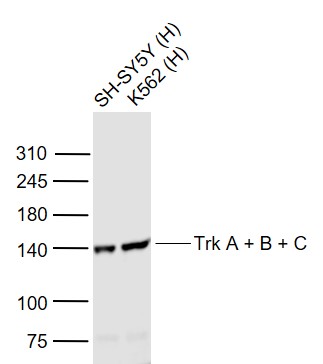 Lane 1: Human SH-SY5Y cell lysates; Lane 2: Human K562 cell lysates probed withTyrosine Kinase Receptor Polyclonal Antibody, Unconjugated (bs-0192R) at 1:1000 dilution and 4˚C overnight incubation. Followed by conjugated secondary antibody incubation at 1:20000 for 60 min at 37˚C.