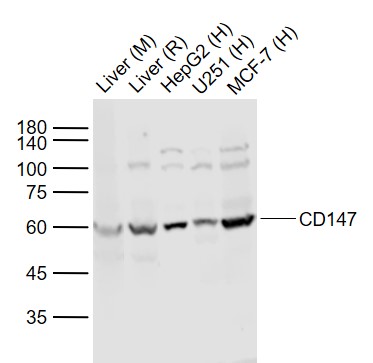 Lane 1: Mouse Liver lysates; Lane 2: Rat Liver lysates; Lane 3: Human HepG2 cell lysates; Lane 4: Human U251 cell lysates; Lane 5: Human MCF-7 cell lysates probed with CD147 Polyclonal Antibody, Unconjugated (bs-0684R) at 1:1000 dilution and 4˚C overnight incubation. Followed by conjugated secondary antibody incubation at 1:20000 for 60 min at 37˚C.