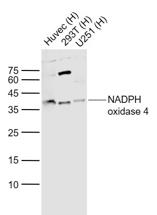 Lane 1: Human HUVEC cell lysates; Lane 2: Human 293T cell lysates; Lane 3: Human U251 cell lysates probed with NADPH oxidase 4 Polyclonal Antibody, Unconjugated (bs-1091R) at 1:1000 dilution and 4˚C overnight incubation. Followed by conjugated secondary antibody incubation at 1:20000 for 60 min at 37˚C. Lane 1: Human HUVEC cell lysates; Lane 2: Human 293T cell lysates; Lane 3: Human U251 cell lysates probed with NADPH oxidase 4 Polyclonal Antibody, Unconjugated (bs-1091R) at 1:1000 dilution and 4˚C overnight incubation. Followed by conjugated secondary antibody incubation at 1:20000 for 60 min at 37˚C.