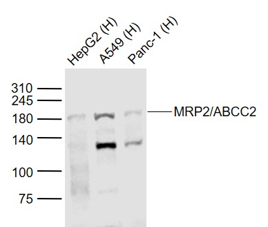 Lane 1: Human HepG2 cell lysates; Lane 2: Human A549 cell lysates; Lane 3: Human Panc-1 cell lysates probed with MRP2 Polyclonal Antibody, Unconjugated (bs-1092R) at 1:1000 dilution and 4˚C overnight incubation. Followed by conjugated secondary antibody incubation at 1:20000 for 60 min at 37˚C.