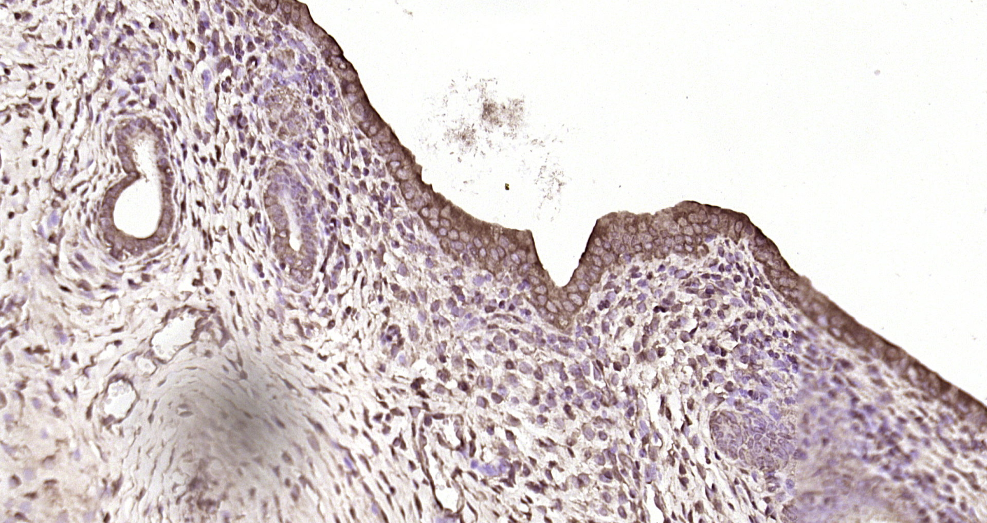 Paraformaldehyde-fixed, paraffin embedded Rat uterus; Antigen retrieval by boiling in sodium citrate buffer (pH6.0) for 15min; Block endogenous peroxidase by 3% hydrogen peroxide for 20 minutes; Blocking buffer (normal goat serum) at 37°C for 30min; Antibody incubation with SAKS1/2B28 Polyclonal Antibody, Unconjugated (bs-18331R) at 1:200 overnight at 4°C, DAB staining.