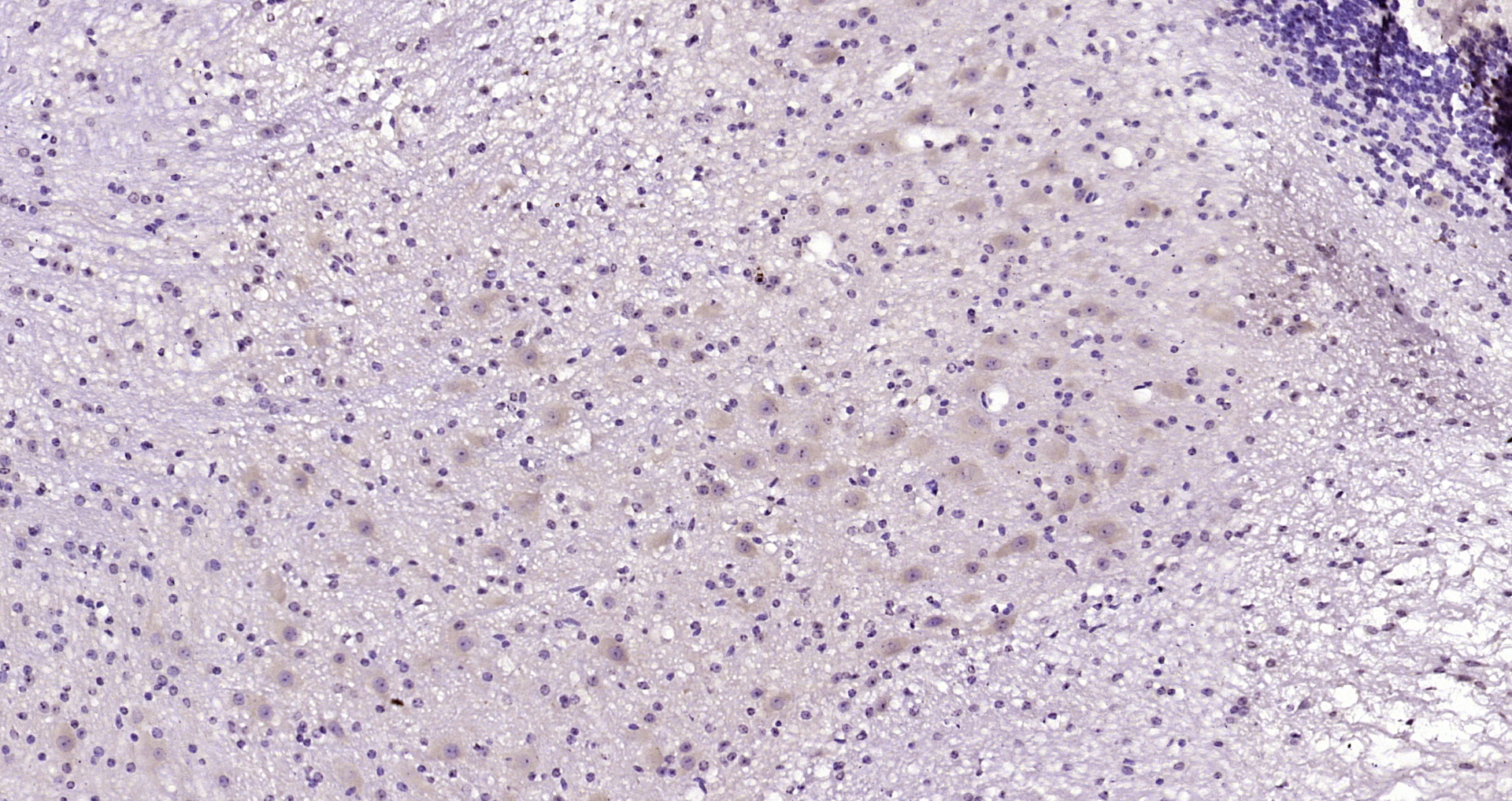 Paraformaldehyde-fixed, paraffin embedded Mouse cerebellum; Antigen retrieval by boiling in sodium citrate buffer (pH6.0) for 15min; Block endogenous peroxidase by 3% hydrogen peroxide for 20 minutes; Blocking buffer (normal goat serum) at 37°C for 30min; Antibody incubation with _x000D_ PAM16 Polyclonal Antibody, Unconjugated (bs-21010R) at 1:200 overnight at 4°C, DAB staining.