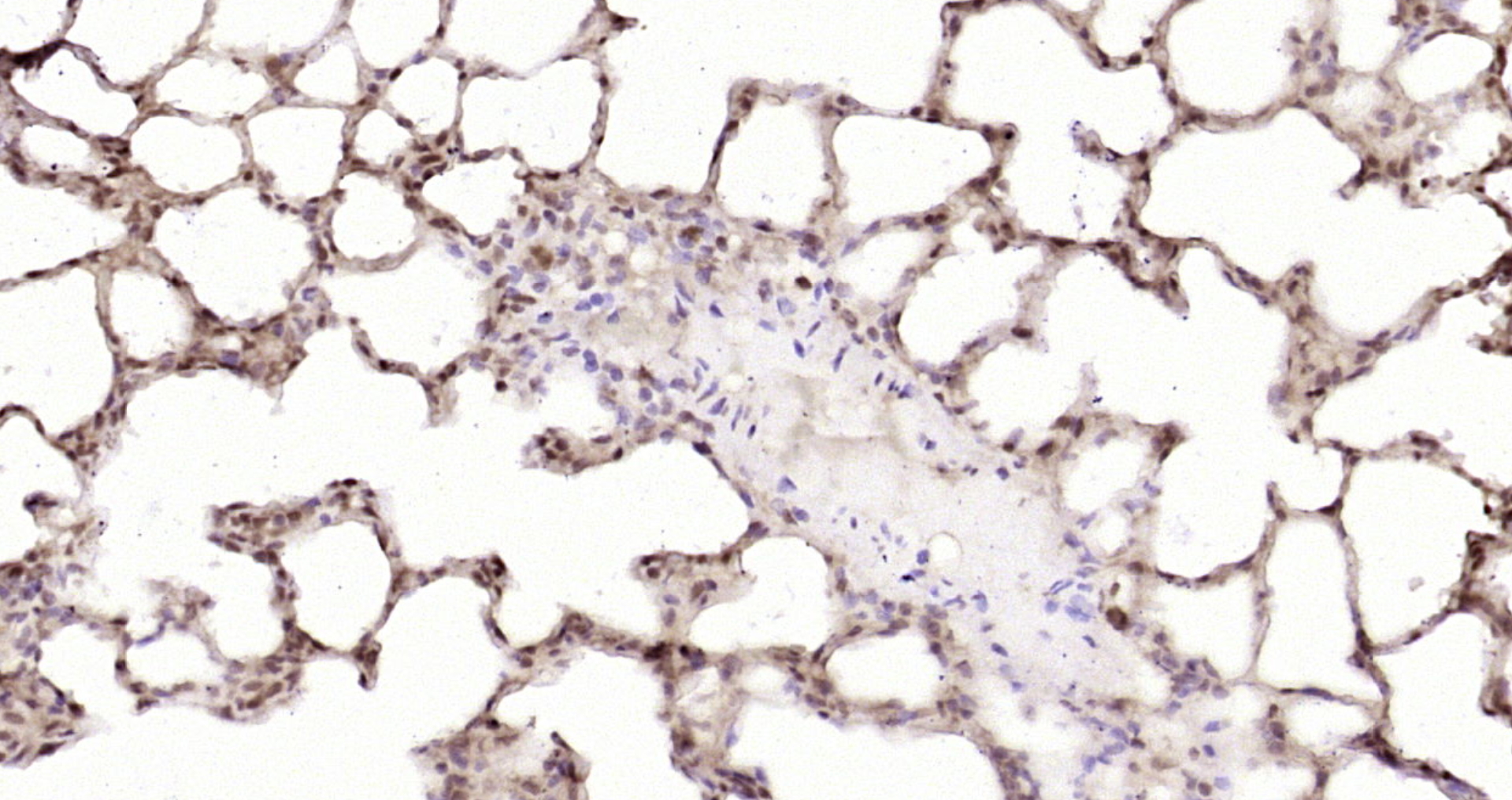 Paraformaldehyde-fixed, paraffin embedded Rat lung; Antigen retrieval by boiling in sodium citrate buffer (pH6.0) for 15min; Block endogenous peroxidase by 3% hydrogen peroxide for 20 minutes; Blocking buffer (normal goat serum) at 37°C for 30min; Antibody incubation with ZNF579 Polyclonal Antibody, Unconjugated (bs-4325R) at 1:200 overnight at 4°C, DAB staining.